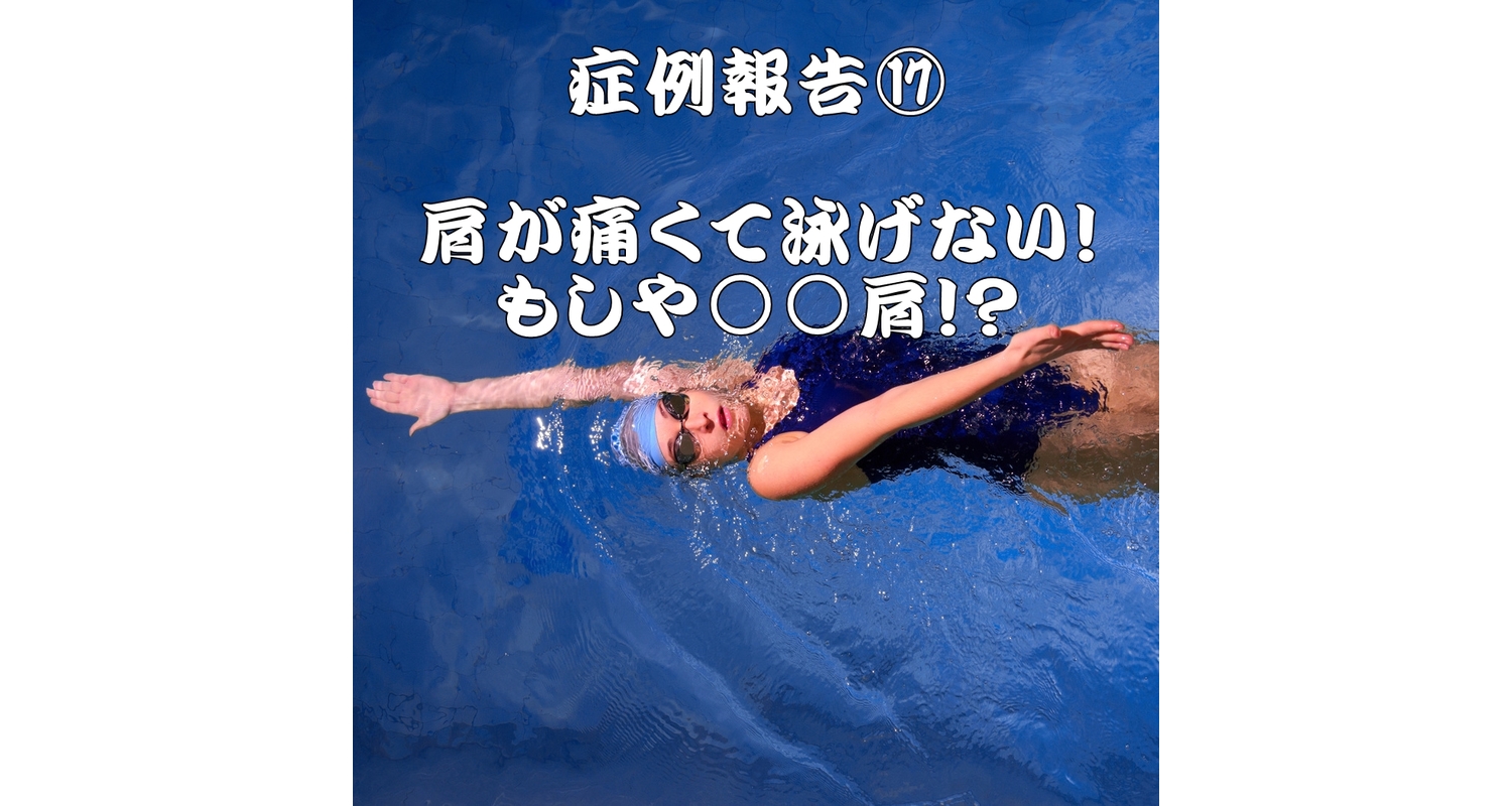 横浜中区元町にある整体/整骨院壱番館が水泳する時の四十肩、五十肩について考える