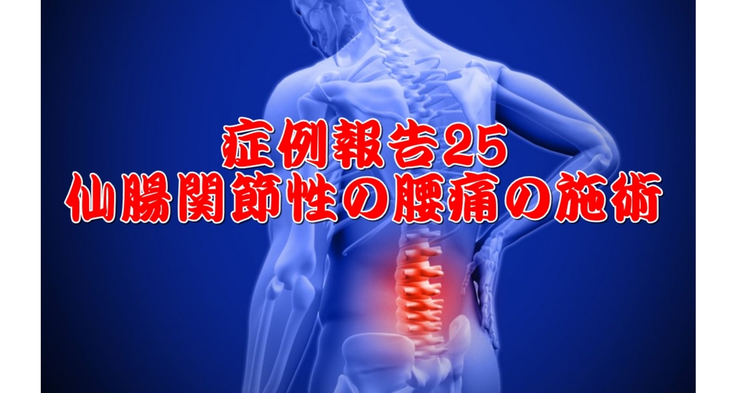 仙腸関節　坐骨神経痛　腰痛