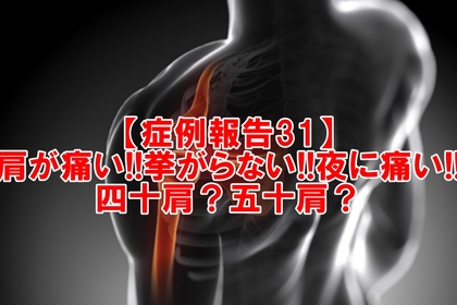 横浜中区元町にある整体/整骨院壱番館が四十肩、五十肩について解説