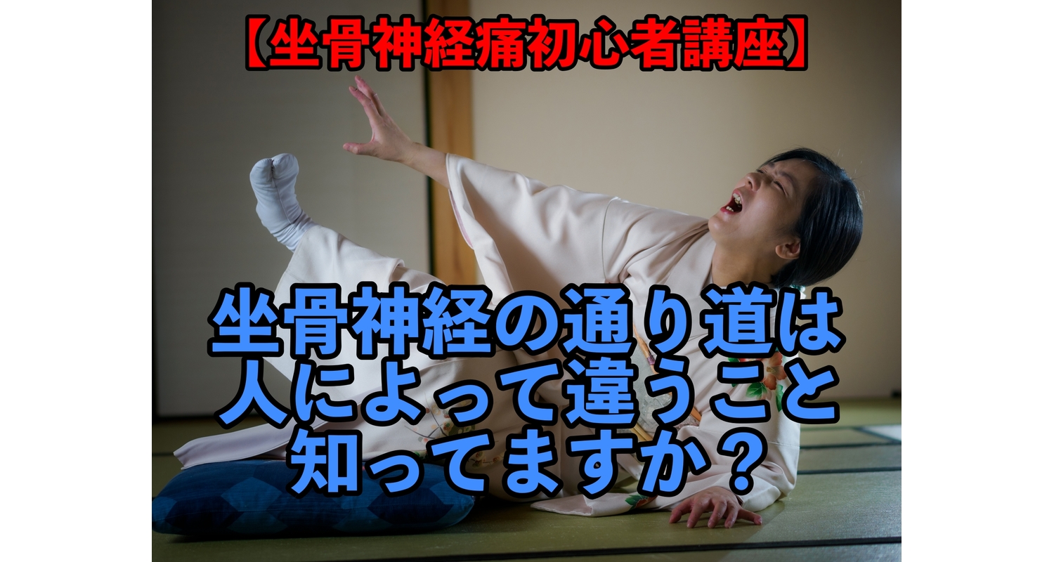 横浜市中区元町にある整体/整骨院壱番館が坐骨神経痛について解説している