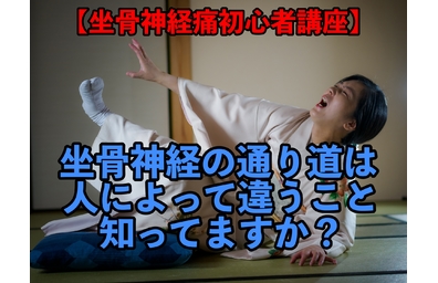 横浜市中区元町にある整体/整骨院壱番館が坐骨神経痛について解説している